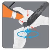 SwellPro Fishing Drone FD1 User Manual - Installation removal method